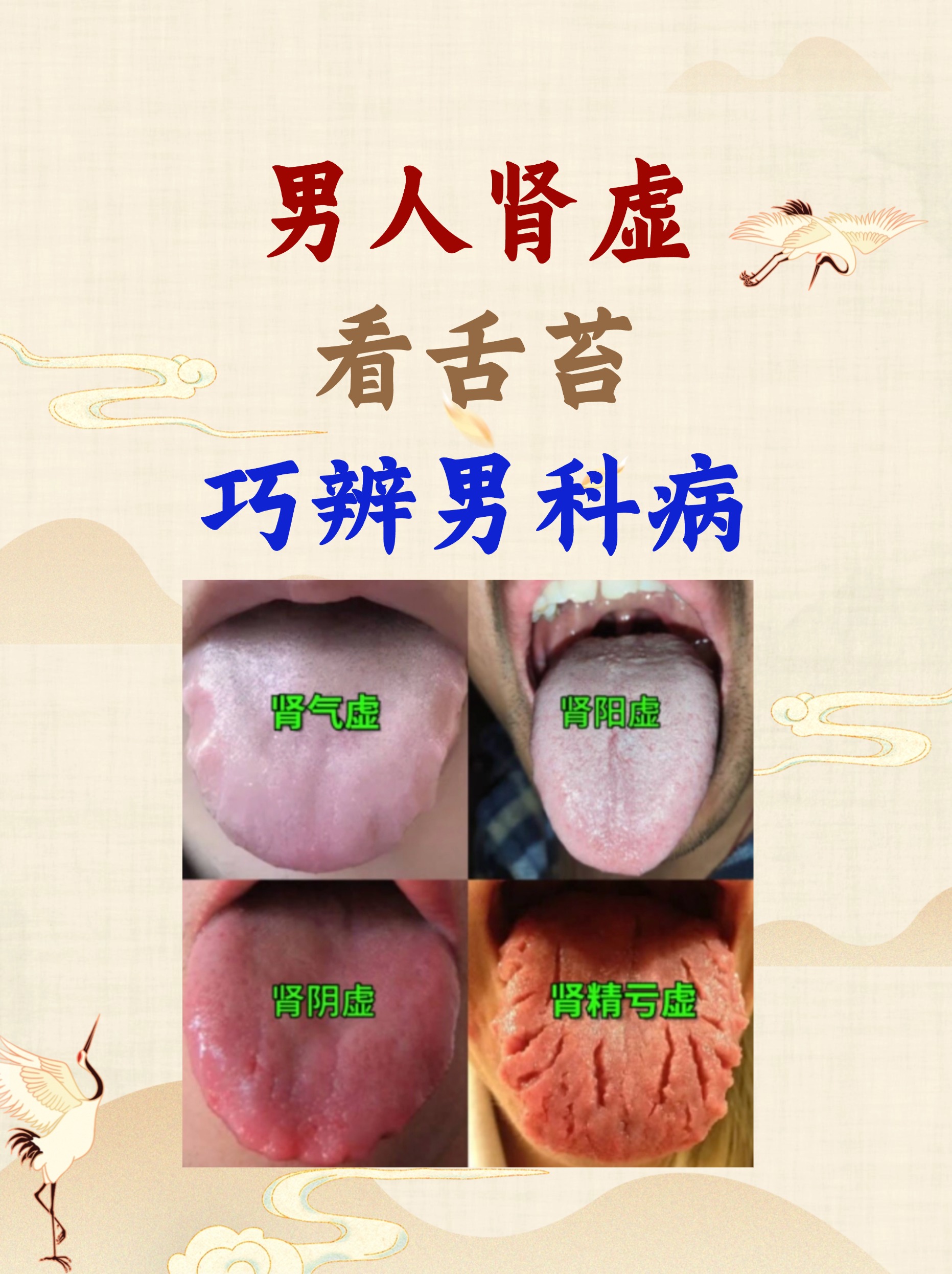 男人肾虚看舌苔巧辨男科病