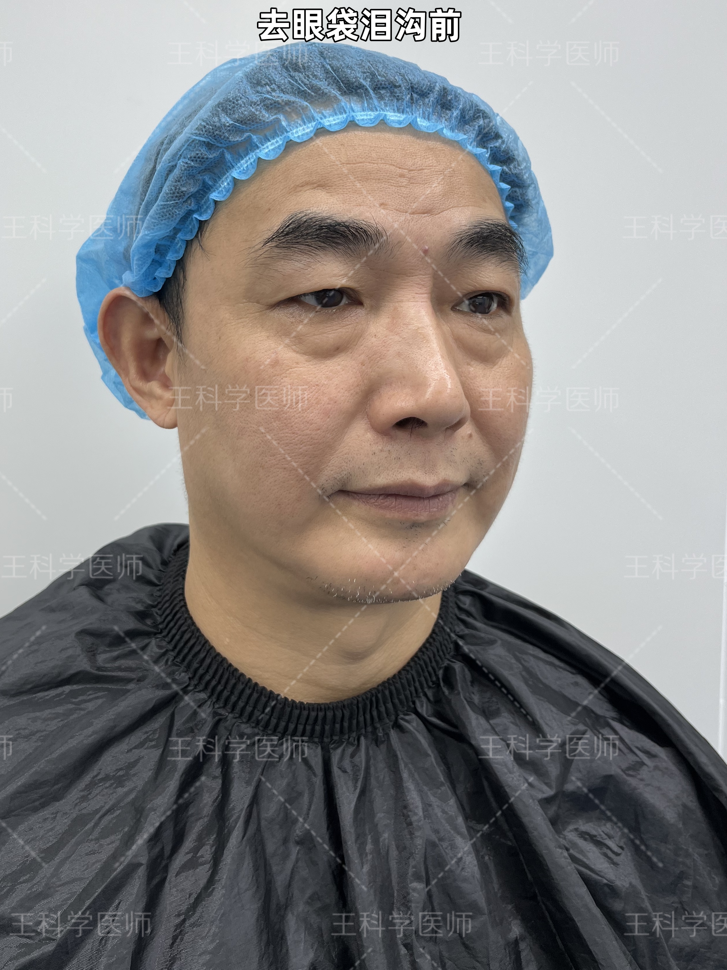 因此感到非常自卑,不自信