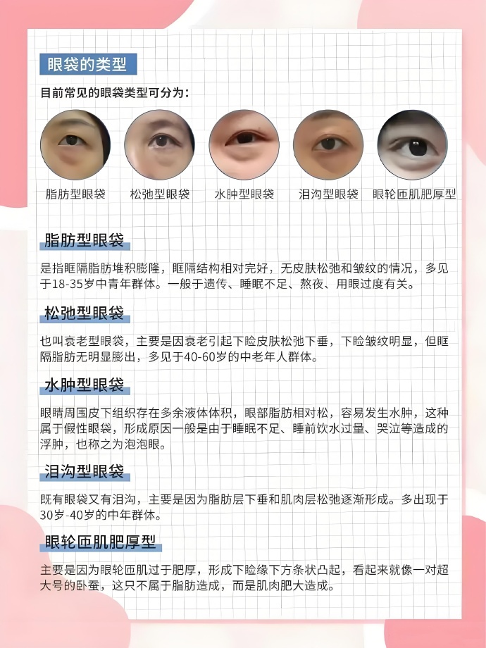 眼袋形成的原因,有以下两点: