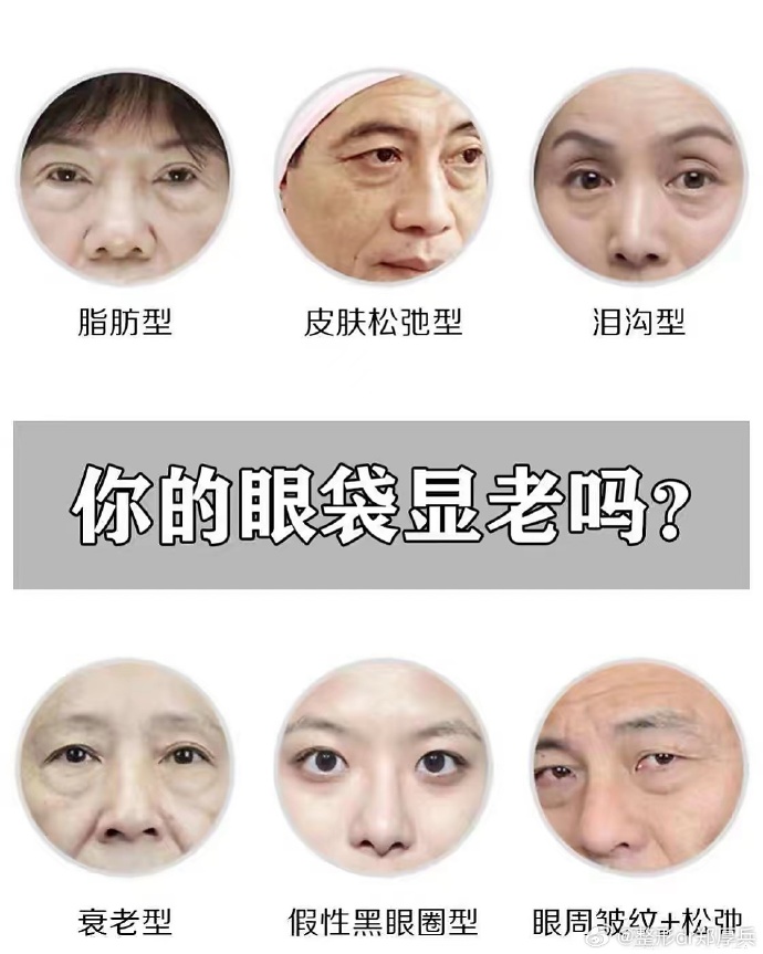 假性眼袋图片