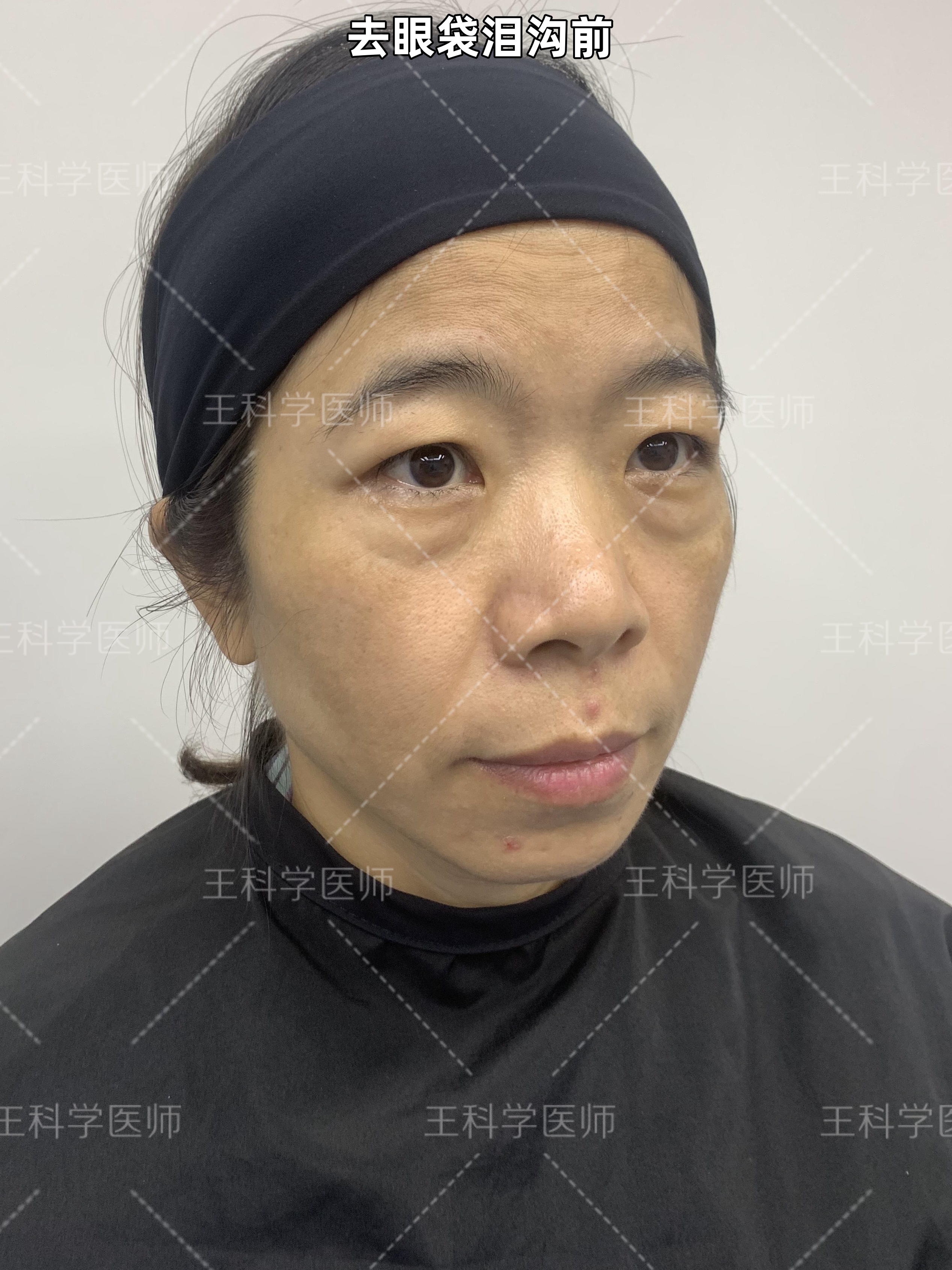 为什么会憔悴 为什么会憔悴