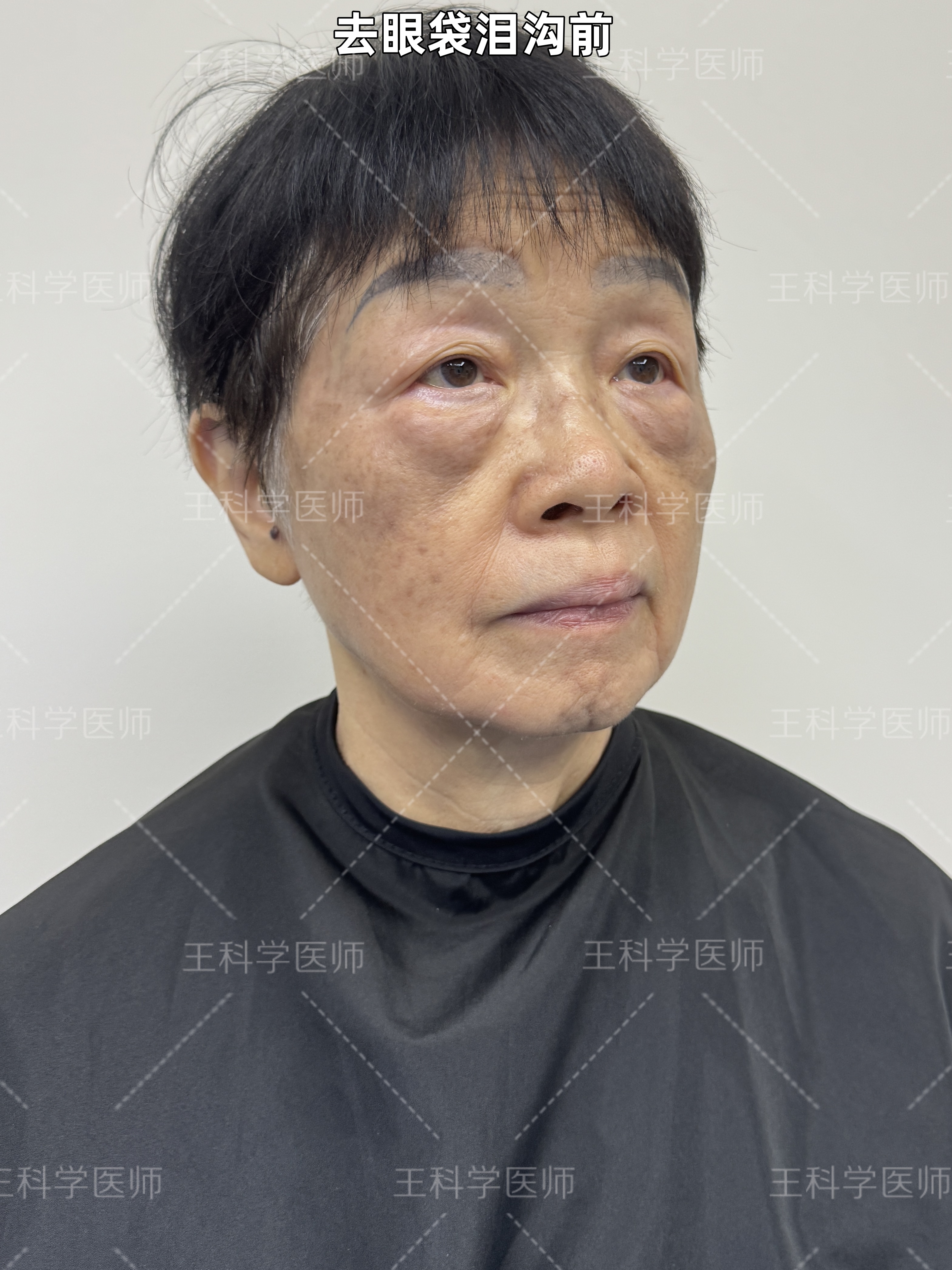 望京医院代挂专家号加代问诊康复训练全程陪同，科学恢复健康的简单介绍