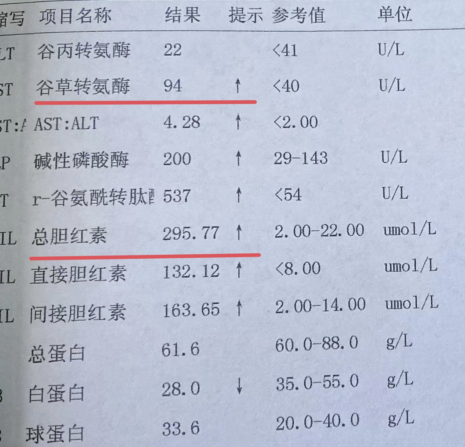 1,转氨酶升高 转氨酶主要存在于肝细胞内,是反应肝细胞受损程度的