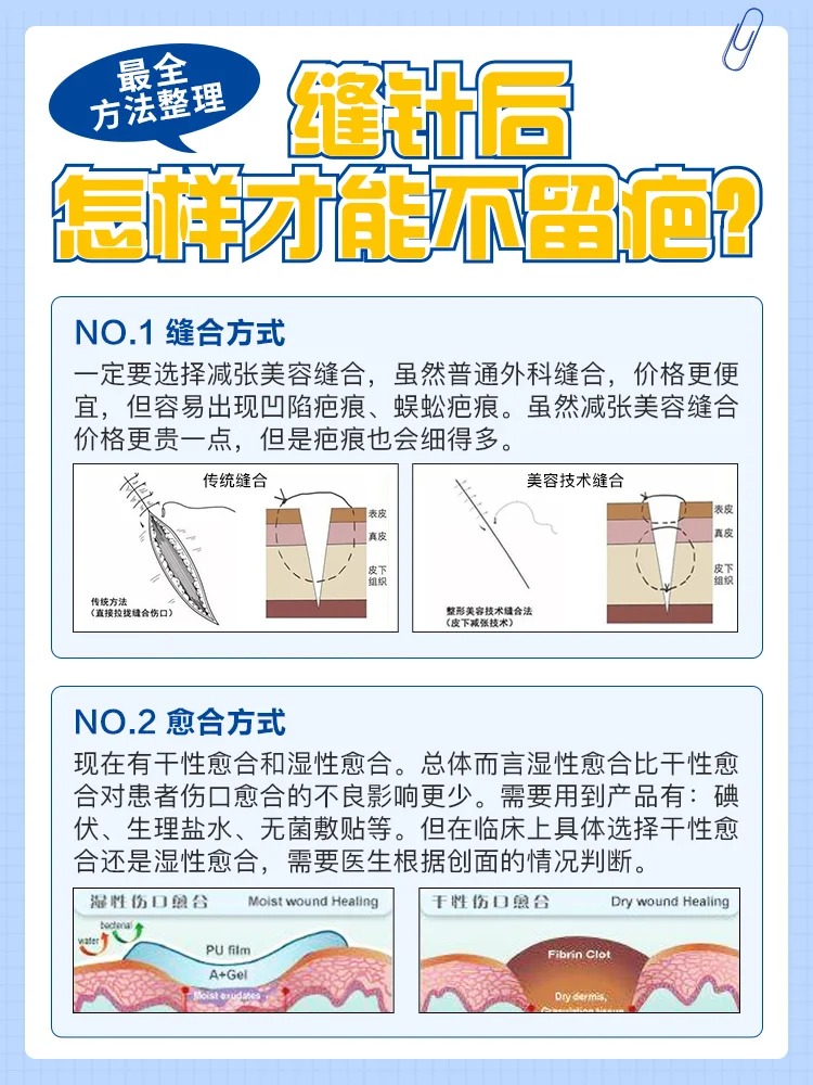 缝合方式: 划重点尽量跟医生沟通好选择减张美容缝合,普通外科缝合