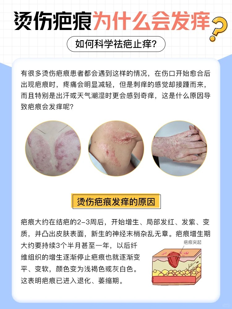 为什么皮肤奇痒无比百科在线