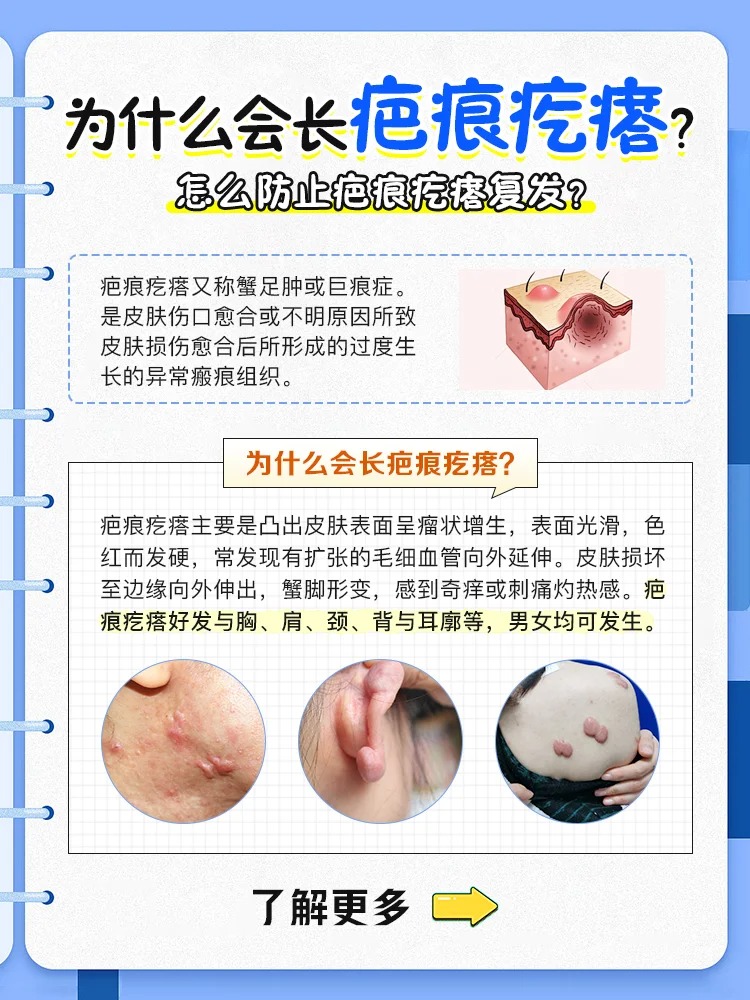手术伤口愈合后,疤痕疯