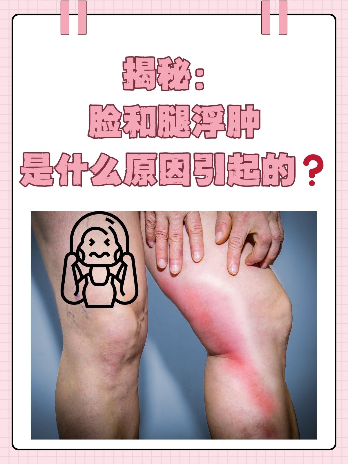 脸为什么会浮肿起来的原因为什么在线 脸为什么会浮肿起来的原因为什么在线