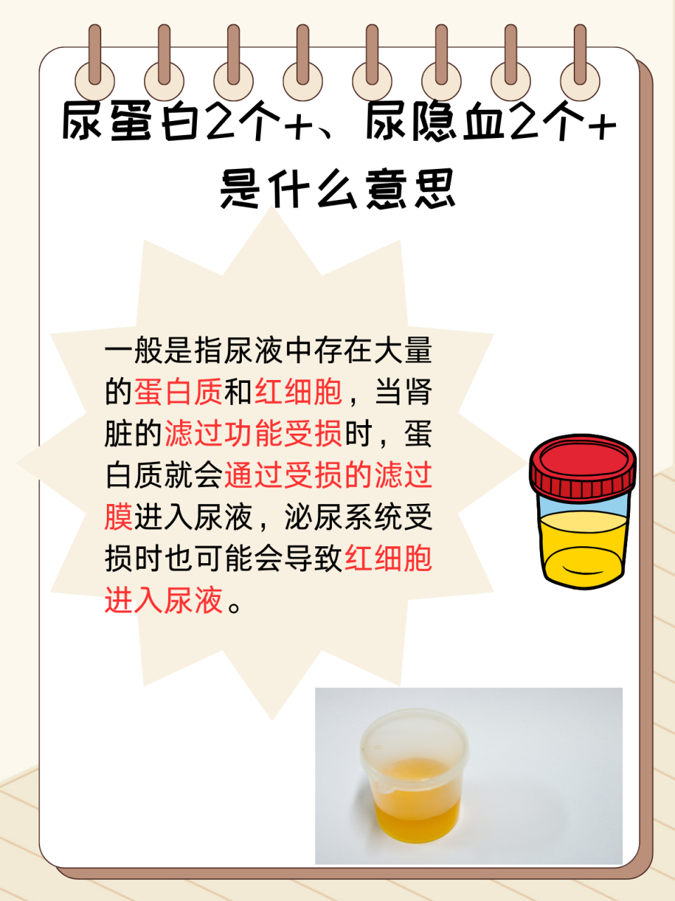 分享:尿蛋白2个 ,尿隐血2个 是什么疾病 尿蛋白和尿隐血都是尿常规