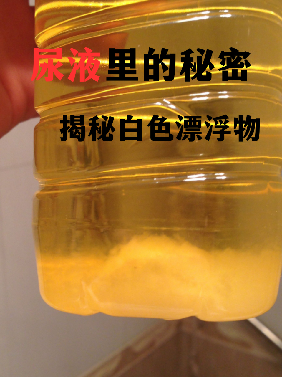 9378  首先,别急着紧张,尿液里偶尔出现白色漂浮物,可能只是个小