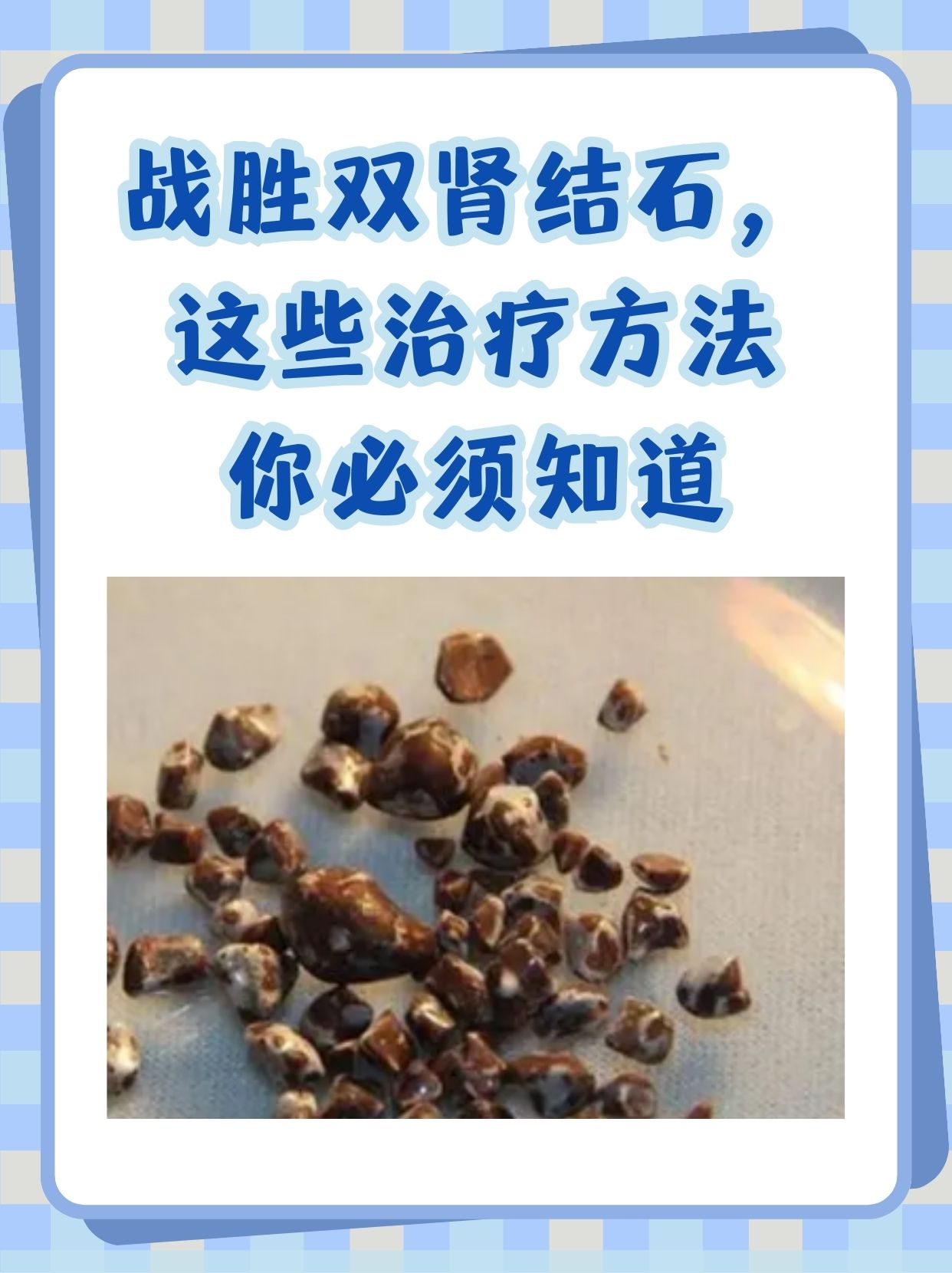 战胜双肾结石,这些治疗方法你必须知道 我们的肾脏就像是两个勤劳的"
