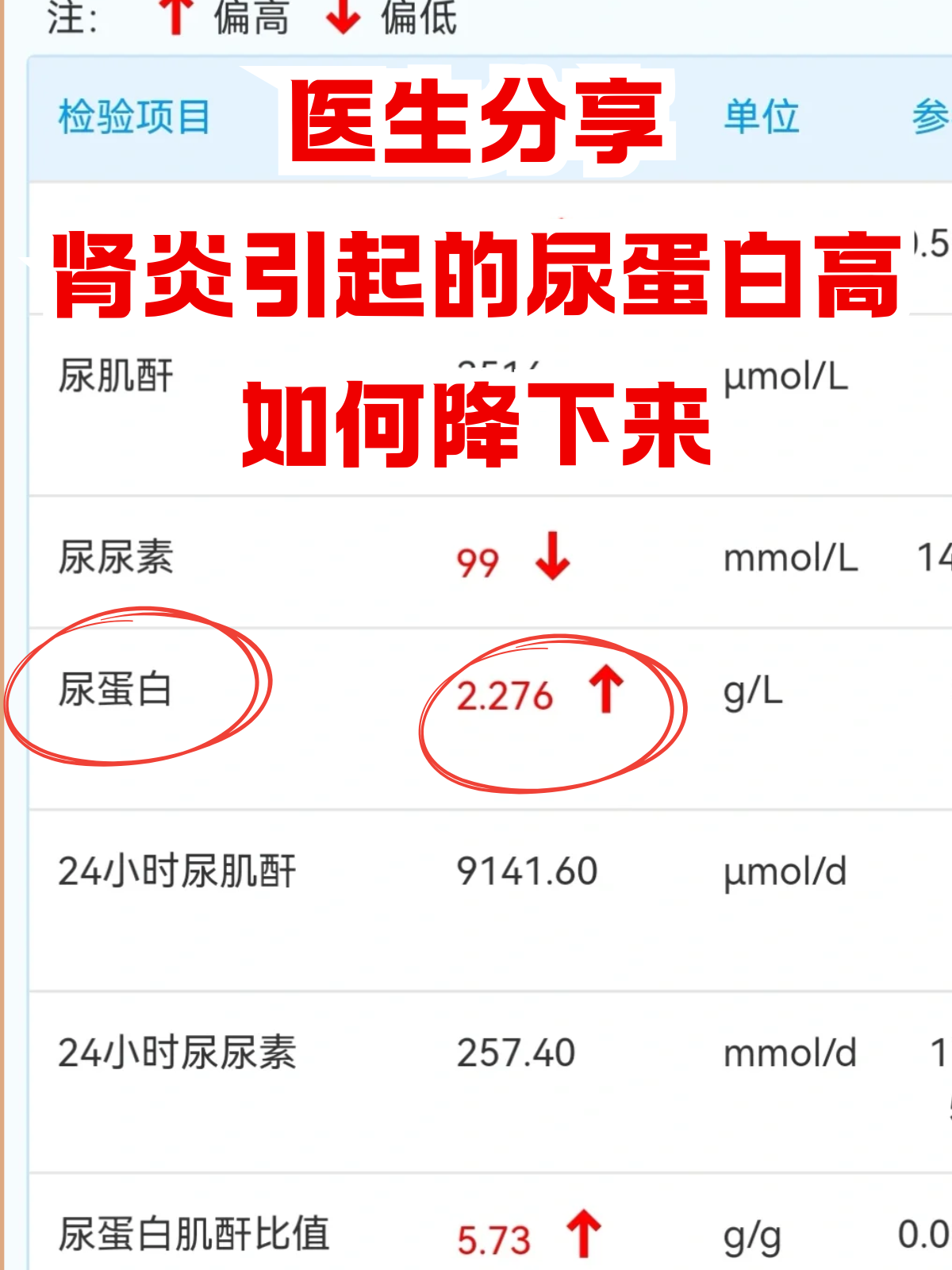尿蛋白高怎么降