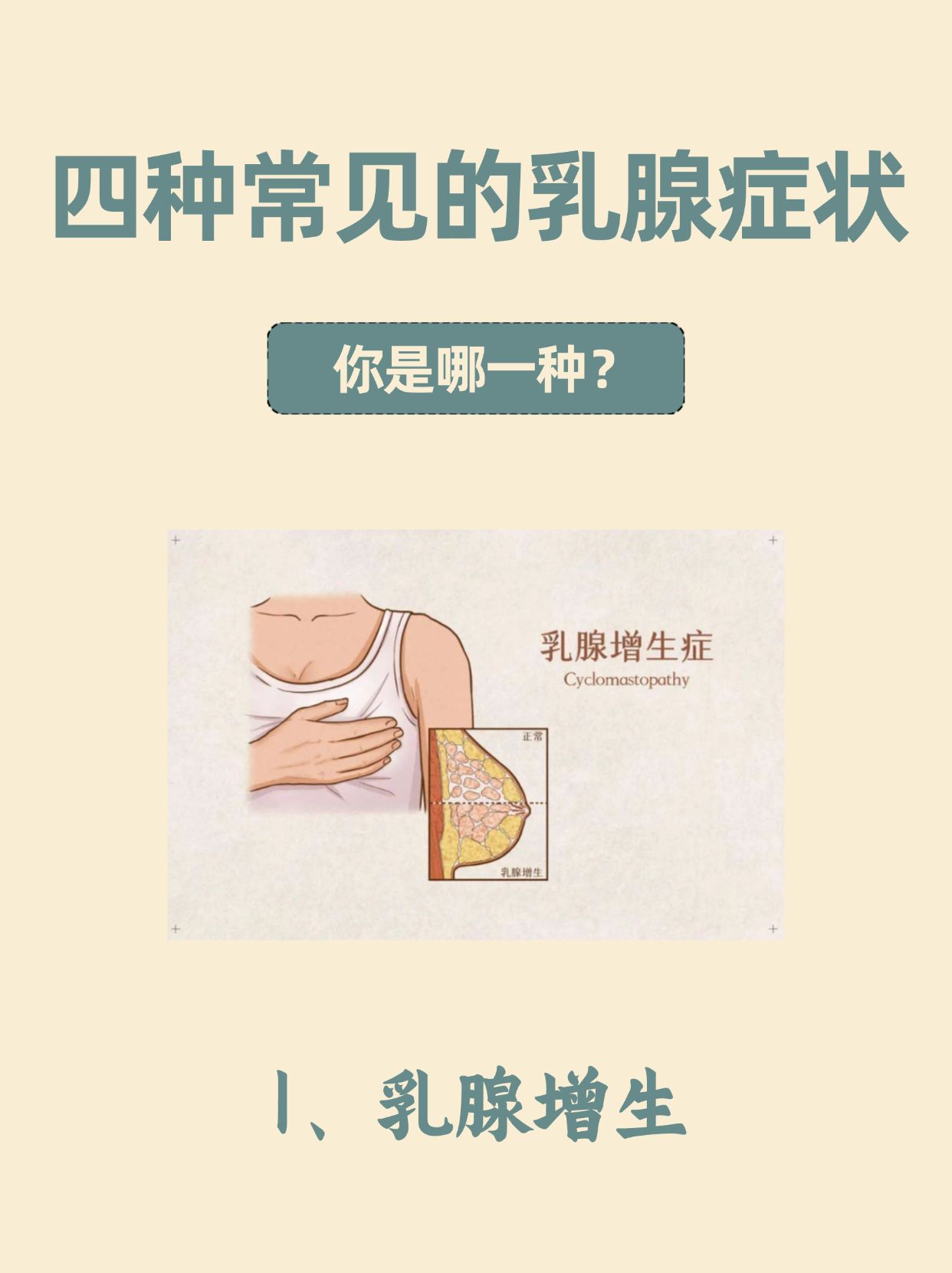 乳腺增生症现象图片