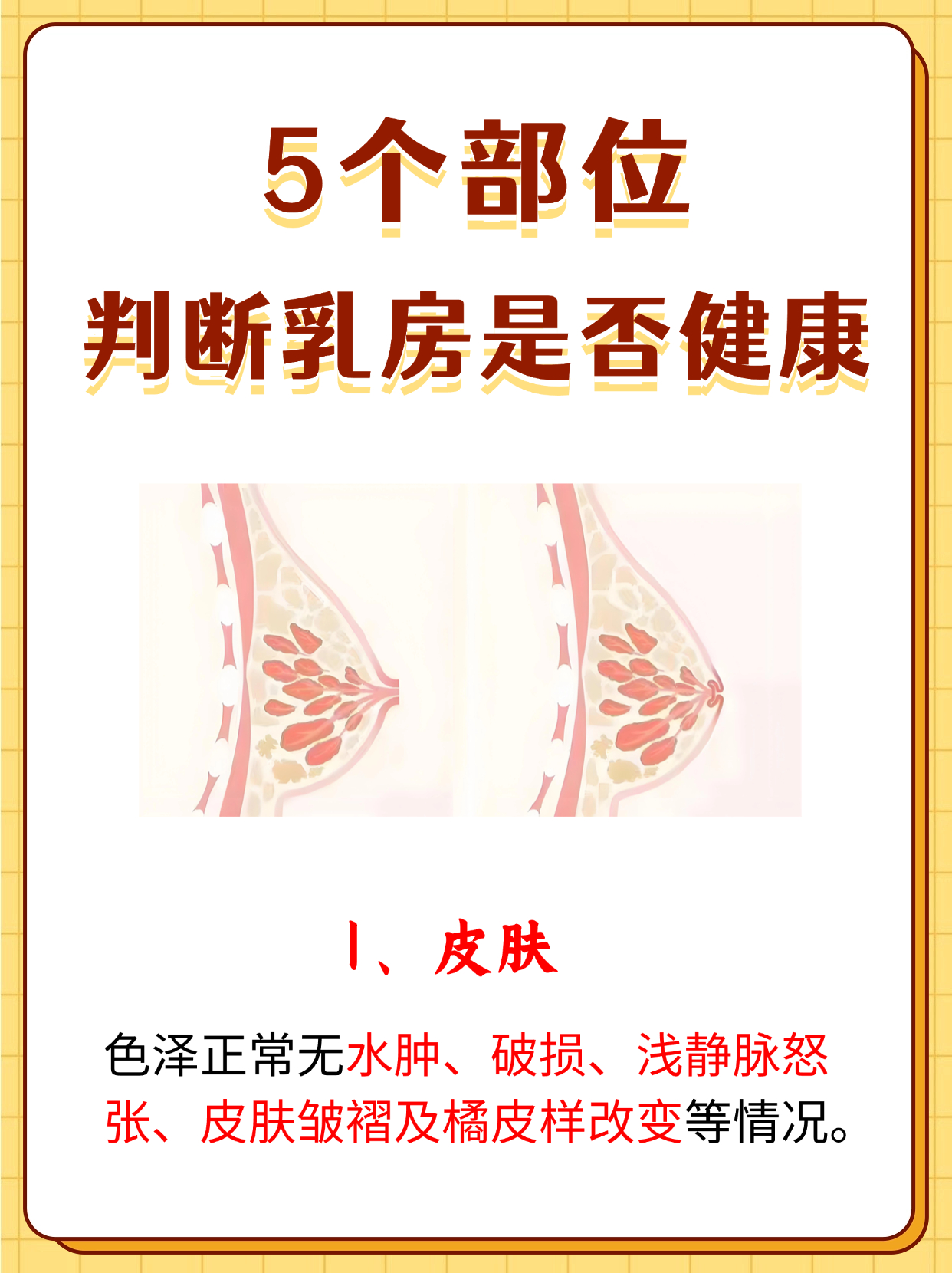 橘皮样乳房早期症状图片