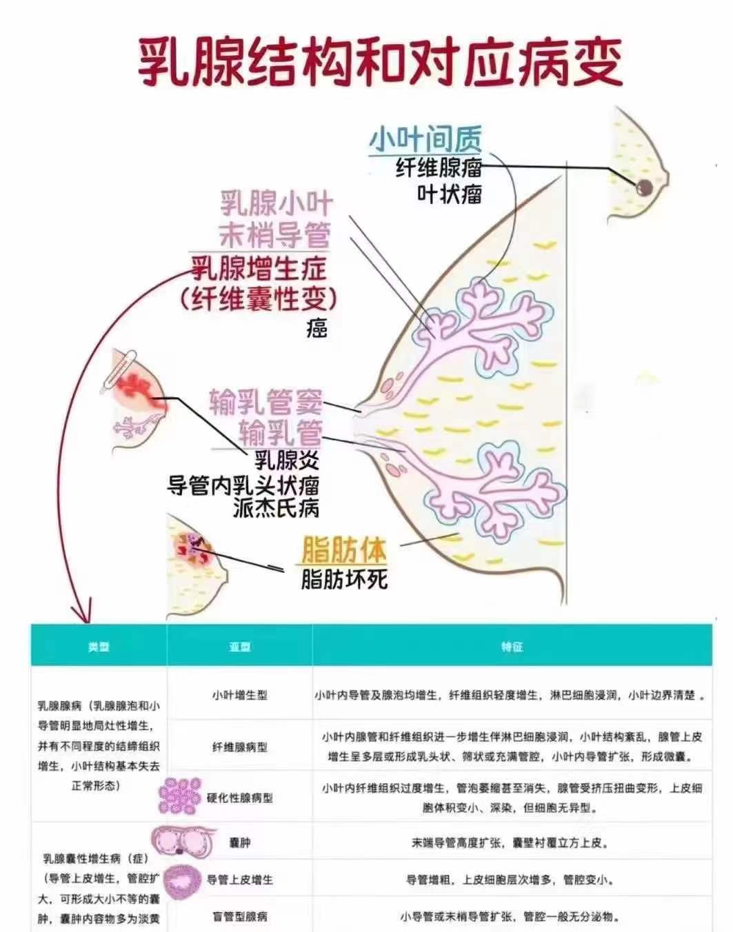 乳房包块形态图片