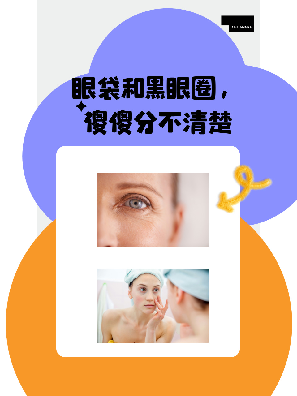 眼袋和黑眼圈,傻傻分不清楚  很多时候咱们总是分不清眼袋和黑眼圈