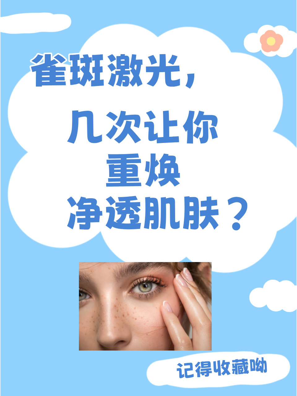 你是不是还在为脸上的雀斑而烦恼?