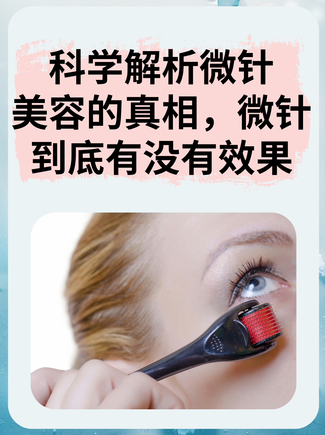 为什么不建议做微针治疗