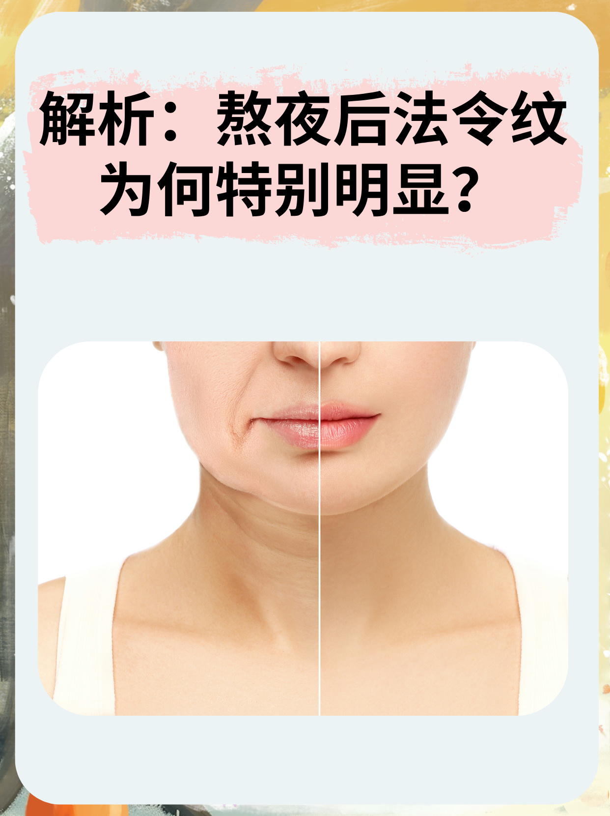 为什么会有法令纹