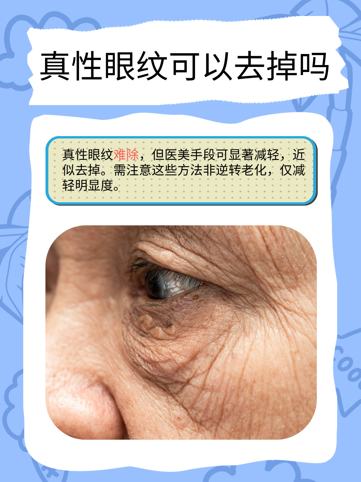 为什么眼部皱纹多,特别显老百科在线 为什么眼部皱纹多,特别显老百科在线