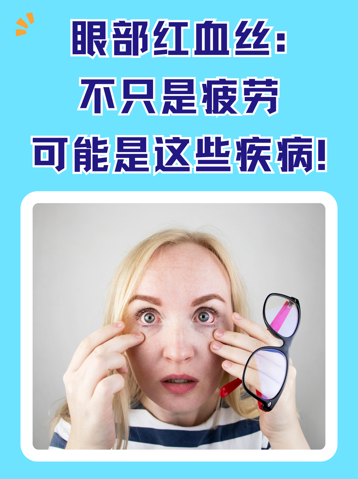 经常觉得眼睛干涩,布满红血丝