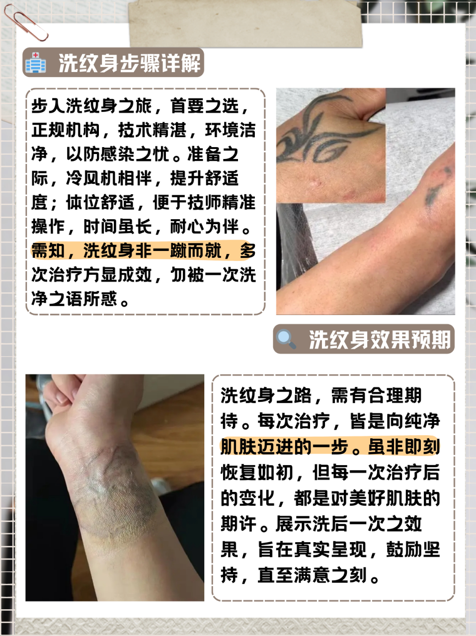 如何洗纹身干净  方法/步骤 1,纹身是针刺入皮肤底层,而在皮肤上制造