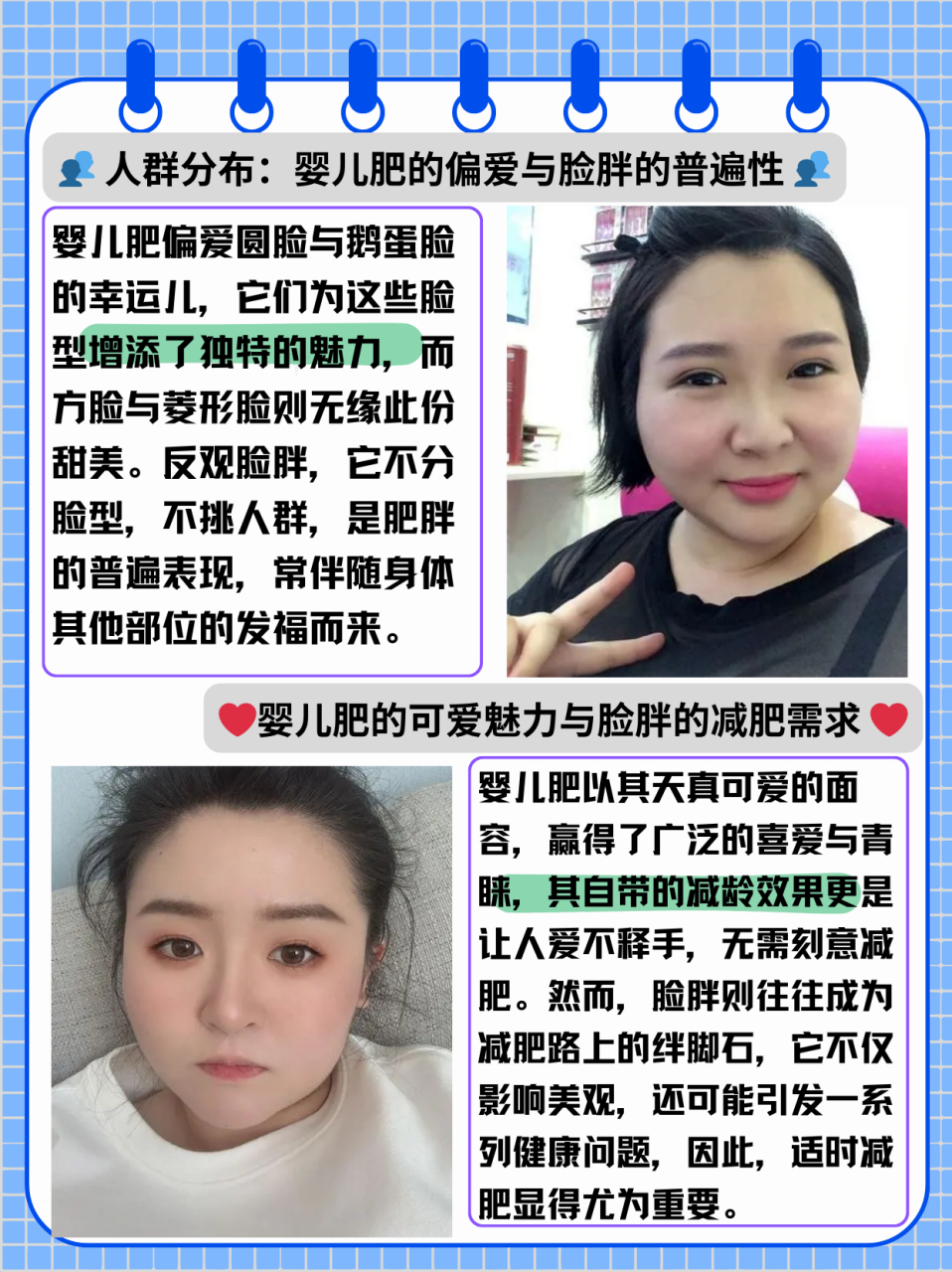 婴儿肥和脸胖的区别是什么  首先婴儿肥属于脸胖的一种,因为脸胖分很
