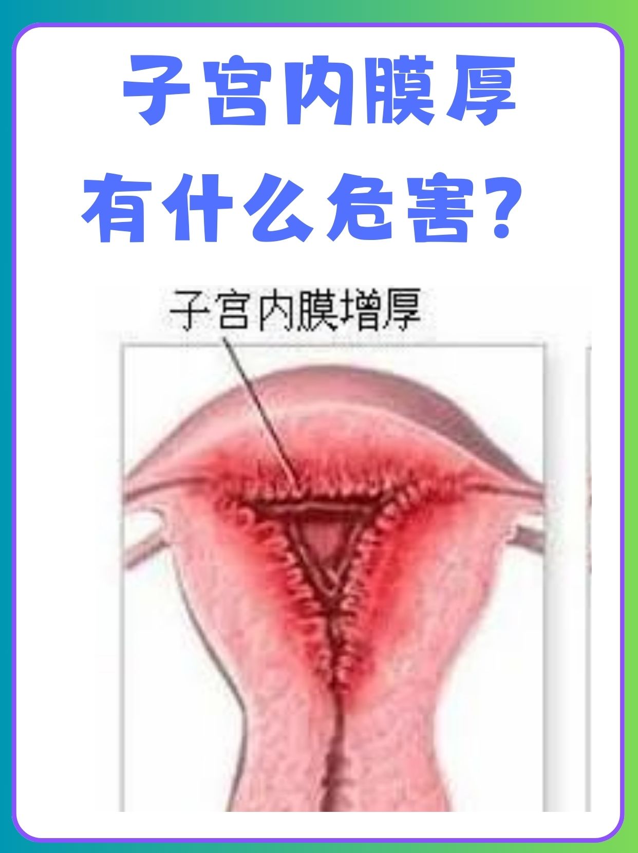 子宫内膜厚有什么危害 在女性生殖健康中,子宫内膜的厚度是一个微妙而