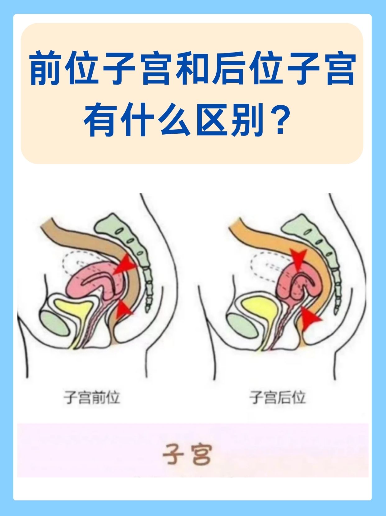 宫角在哪里 示意图图片