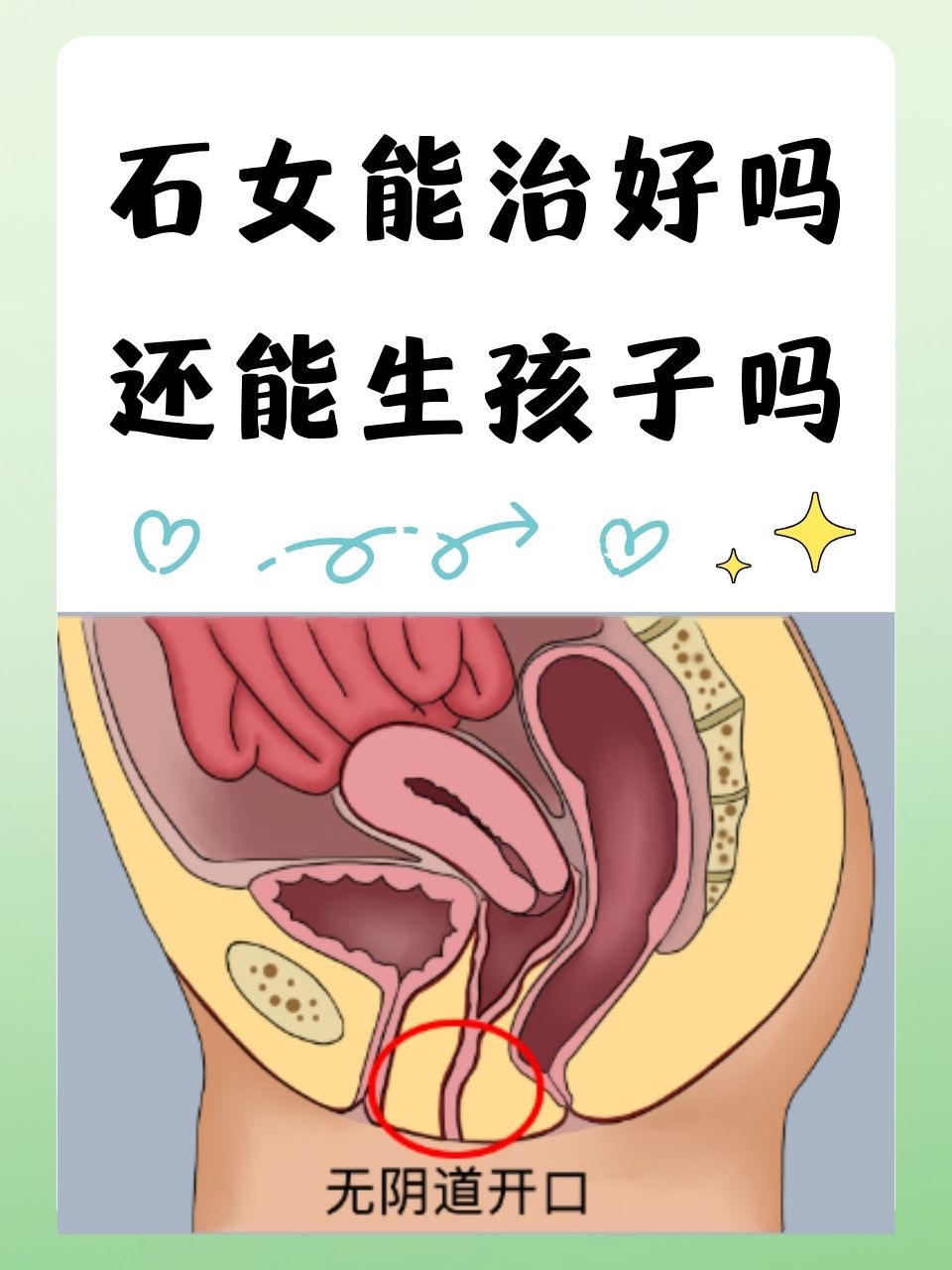 女生的蛋疼达到图片