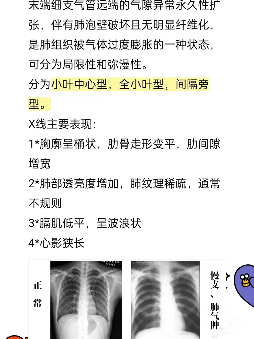 剑突多大图片