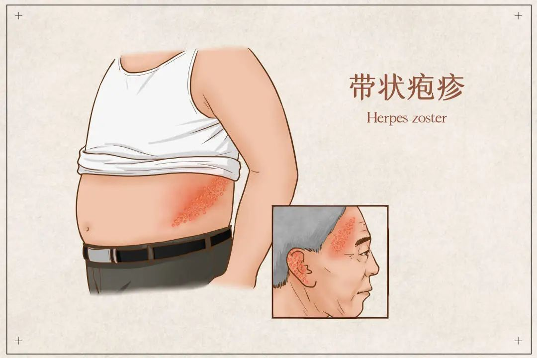  疫情病毒后遗症有哪些表现(疫情是什么意思)