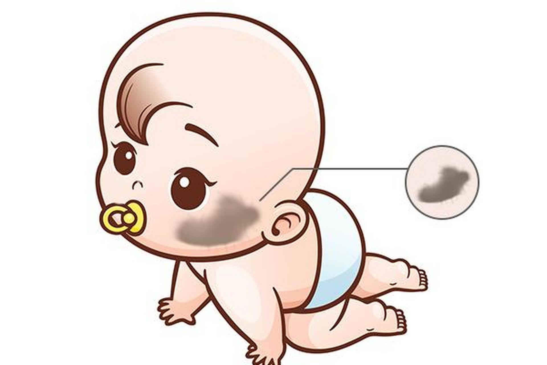 胎记# 02在人们的肌肤上,有时会出现一种特殊的印记,我们称之为"