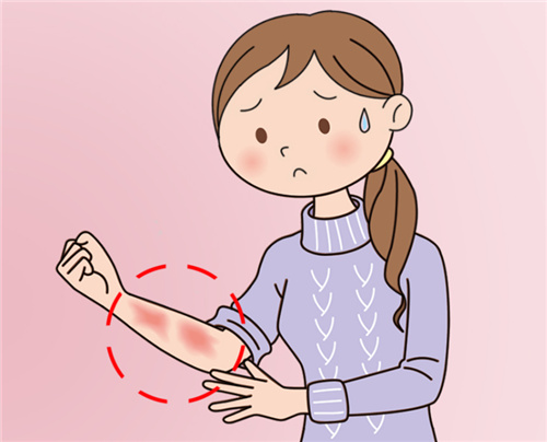 色素性疤痕野毯卡通伤疤 卡通疤痕漫画疤痕卡通图片伤疤卡通伤口卡通