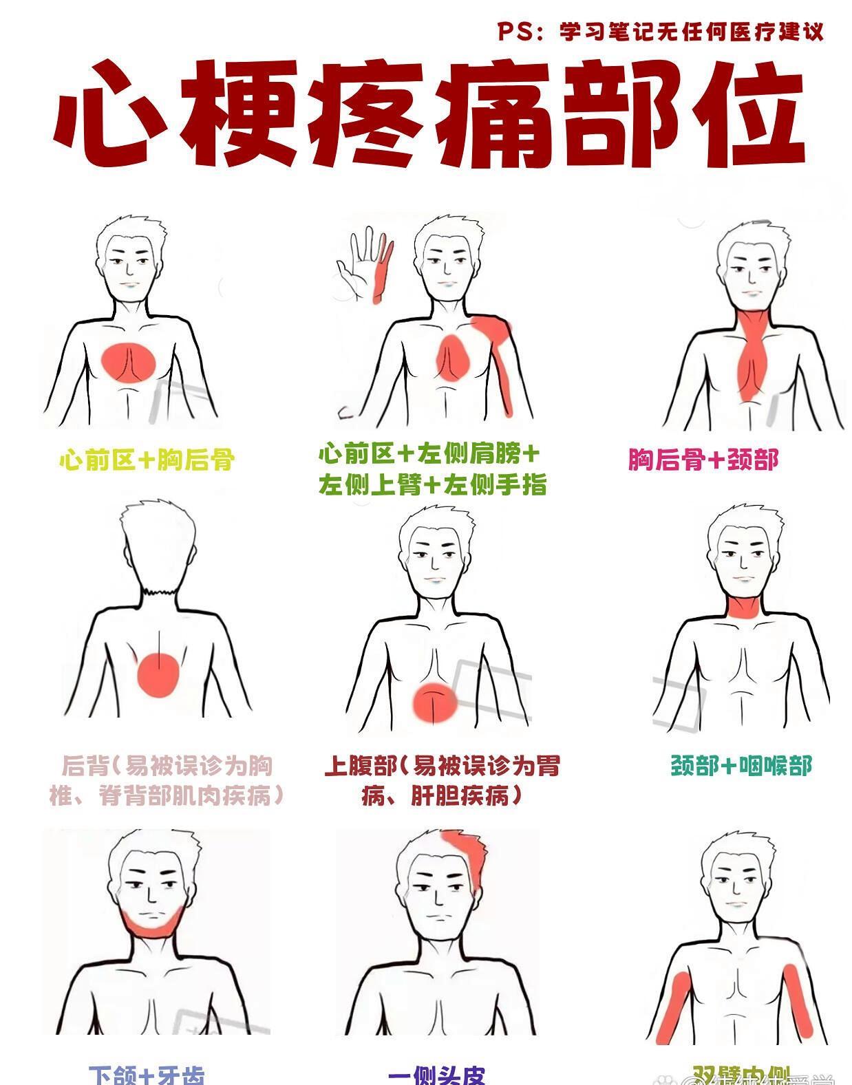 胸口隐隐作痛疼痛部位对照表胸口结构图位置疼痛心脏疼痛的位置图