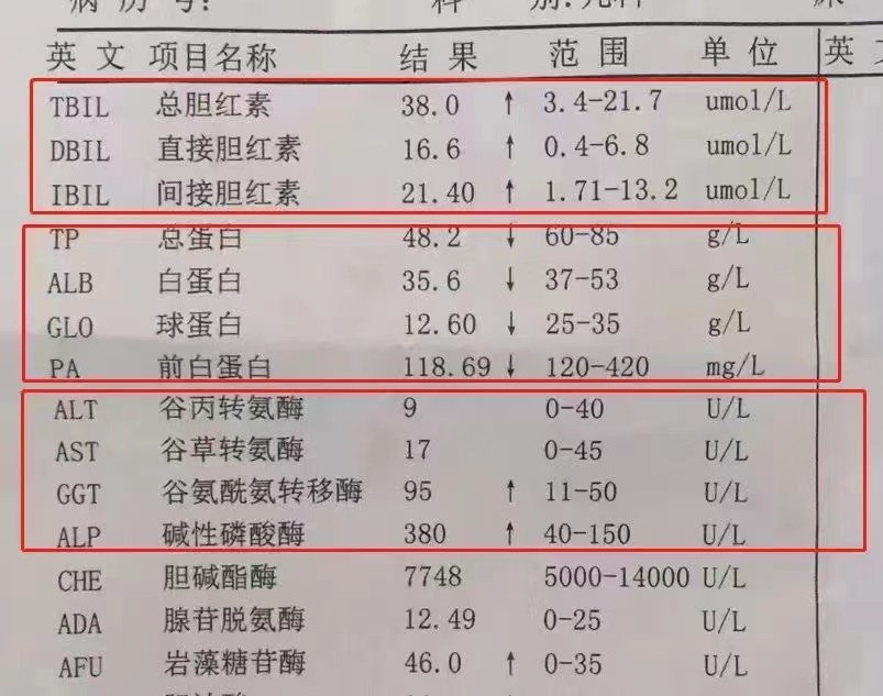 肝功能检查主要看这3项 1