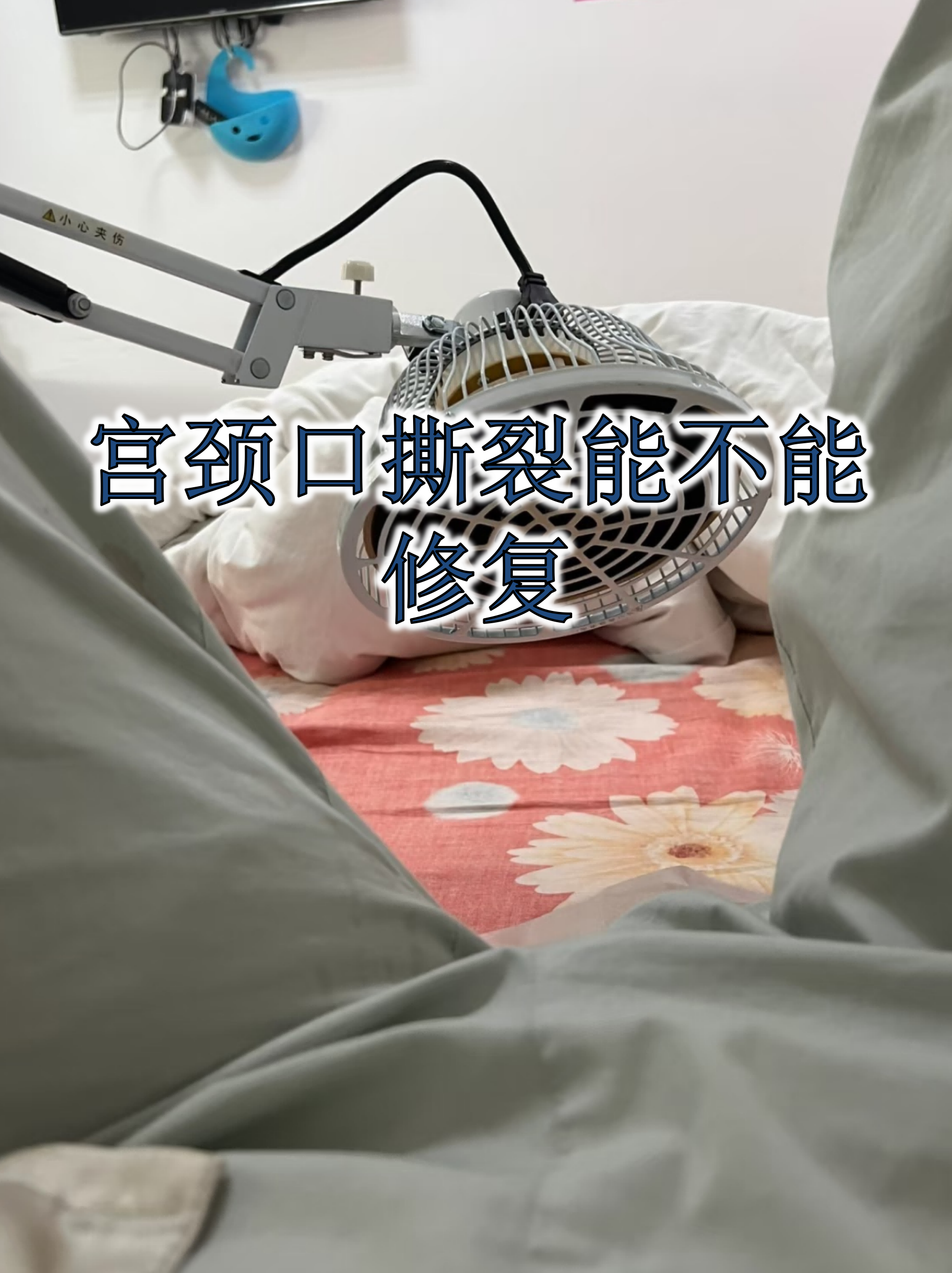 宫颈口撕裂能不能修复