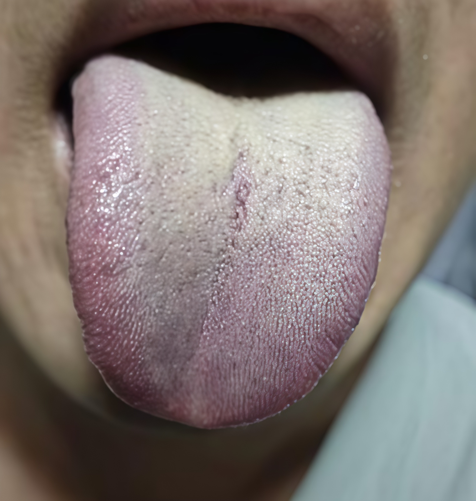 不少朋友明明身体已经被掏空,呈现出疲惫不