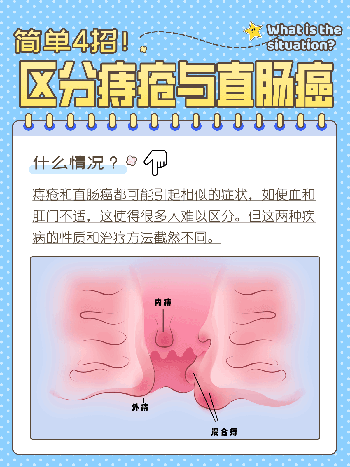 正常肛门和痔疮区别图图片