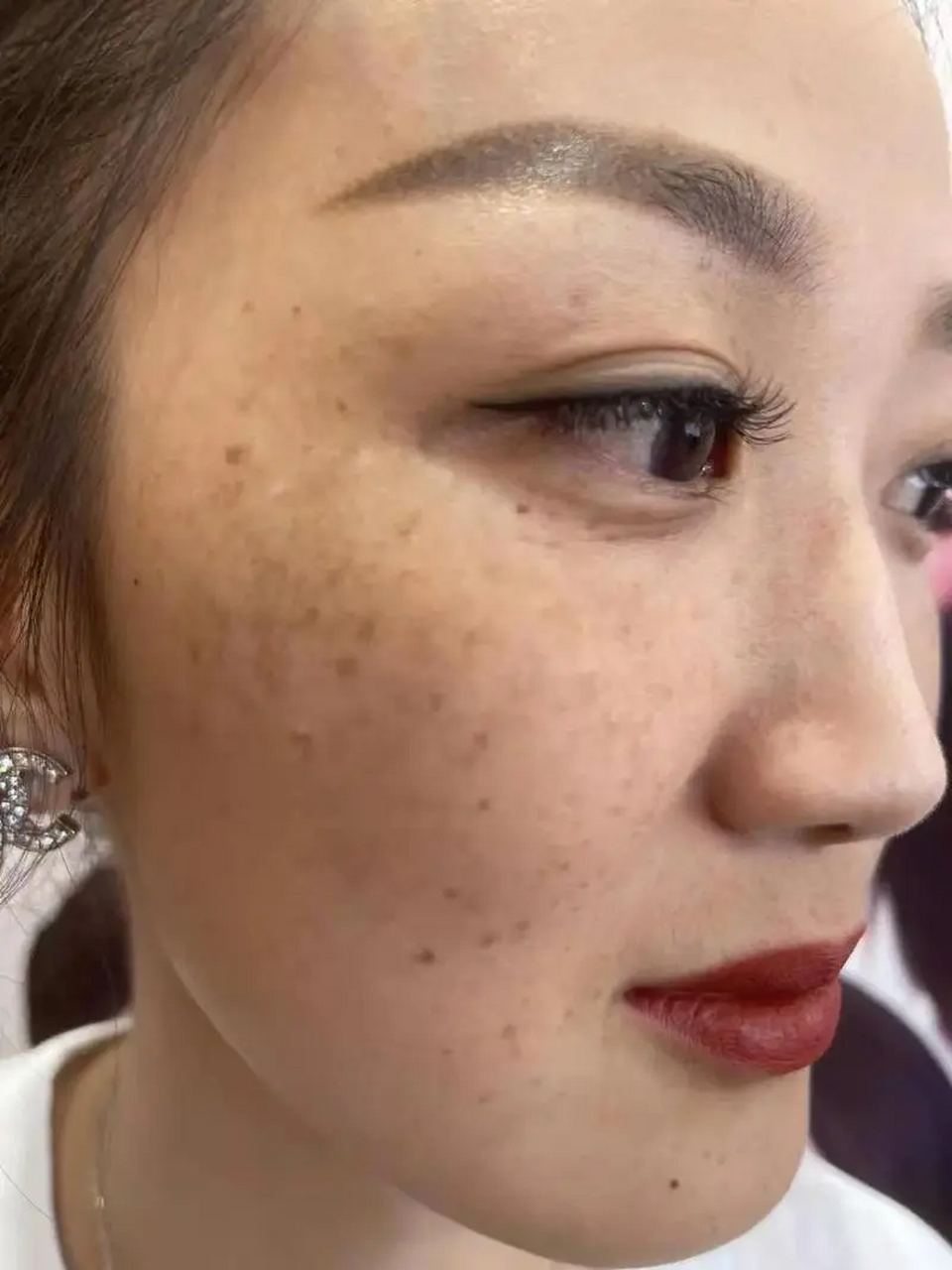 黄褐斑想要好得快,脸皮一定要够厚!