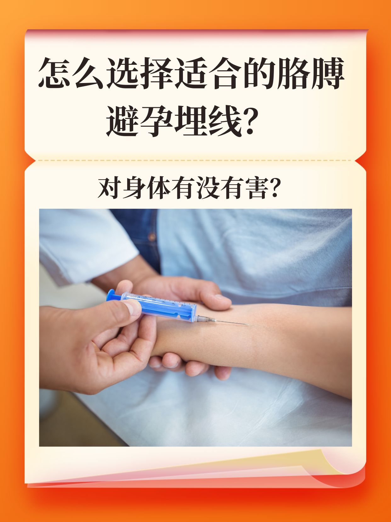 胳膊避孕埋线作为一种长效避孕方法,越来越受到女性的青睐