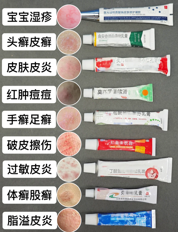 我发现很多新手家长在面对宝宝湿疹时,常常会盲目使用一些产品,结果