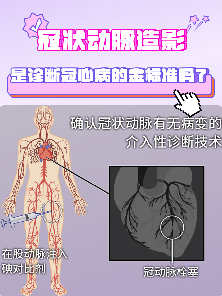 冠状动脉造影,是诊断冠心病的金标准吗?