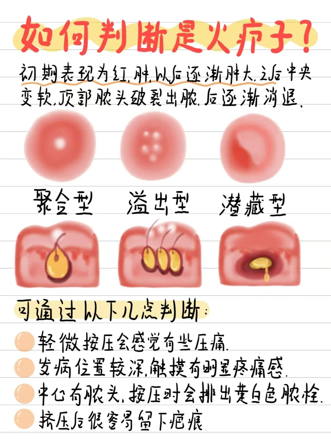 疖是单个毛囊或毛囊周围的化脓性感染,主要以金黄色