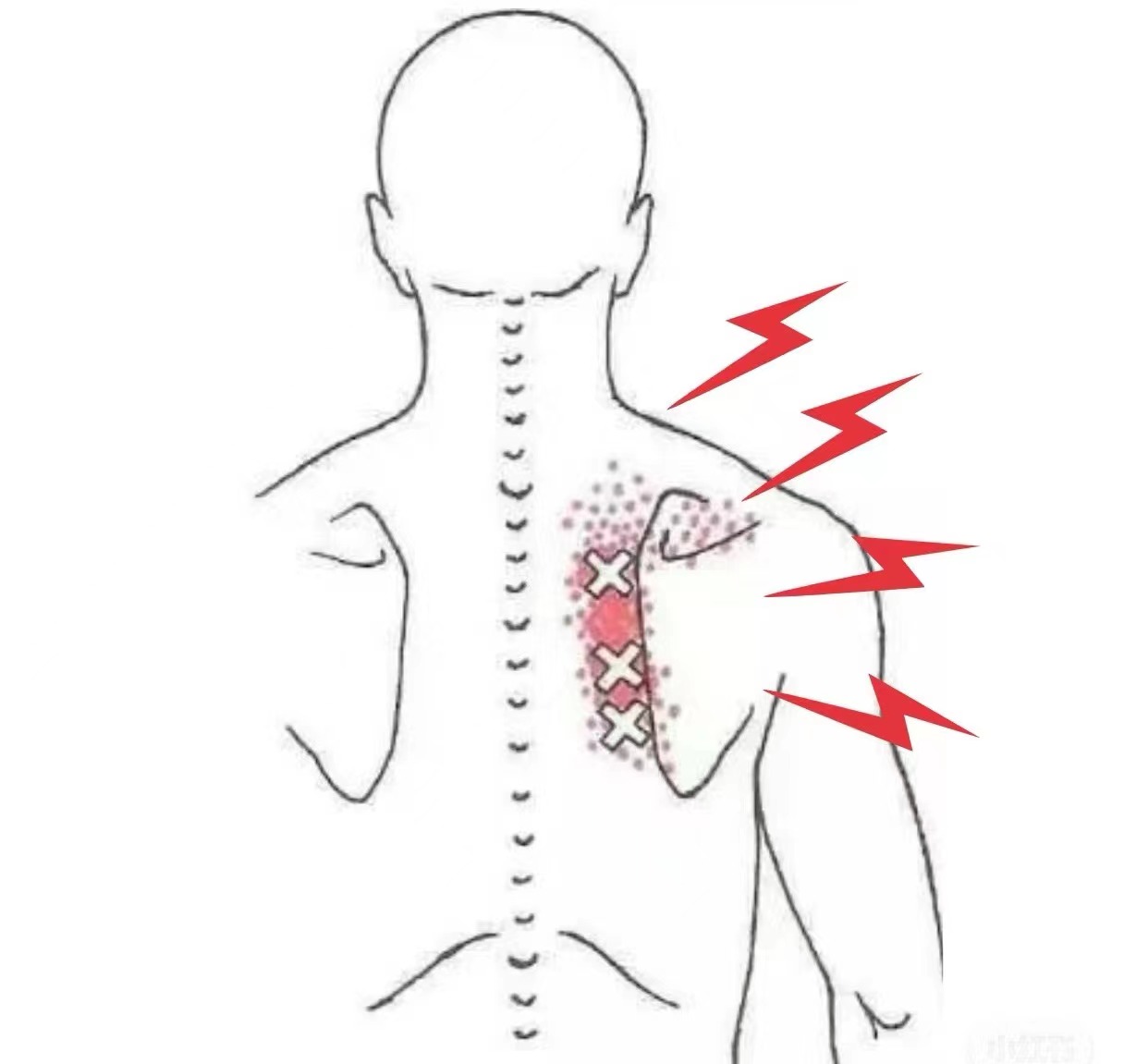 肩周位置图图片