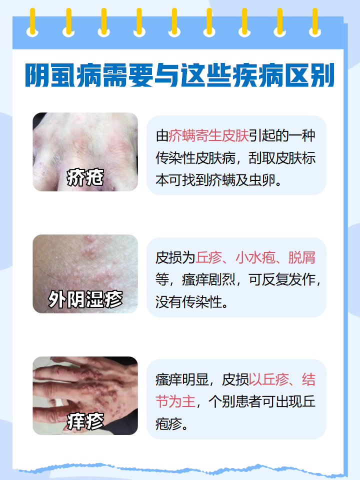 阴虱是一种寄生于人体毛发的寄生虫,多寄生在阴毛处,靠吸食人血晰生