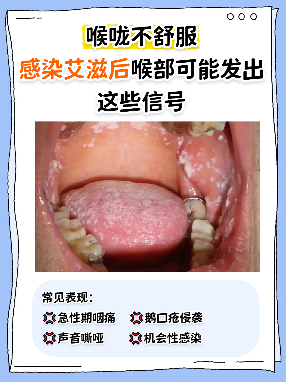 有没有阳康后喉咙持续半年不好的百科在线