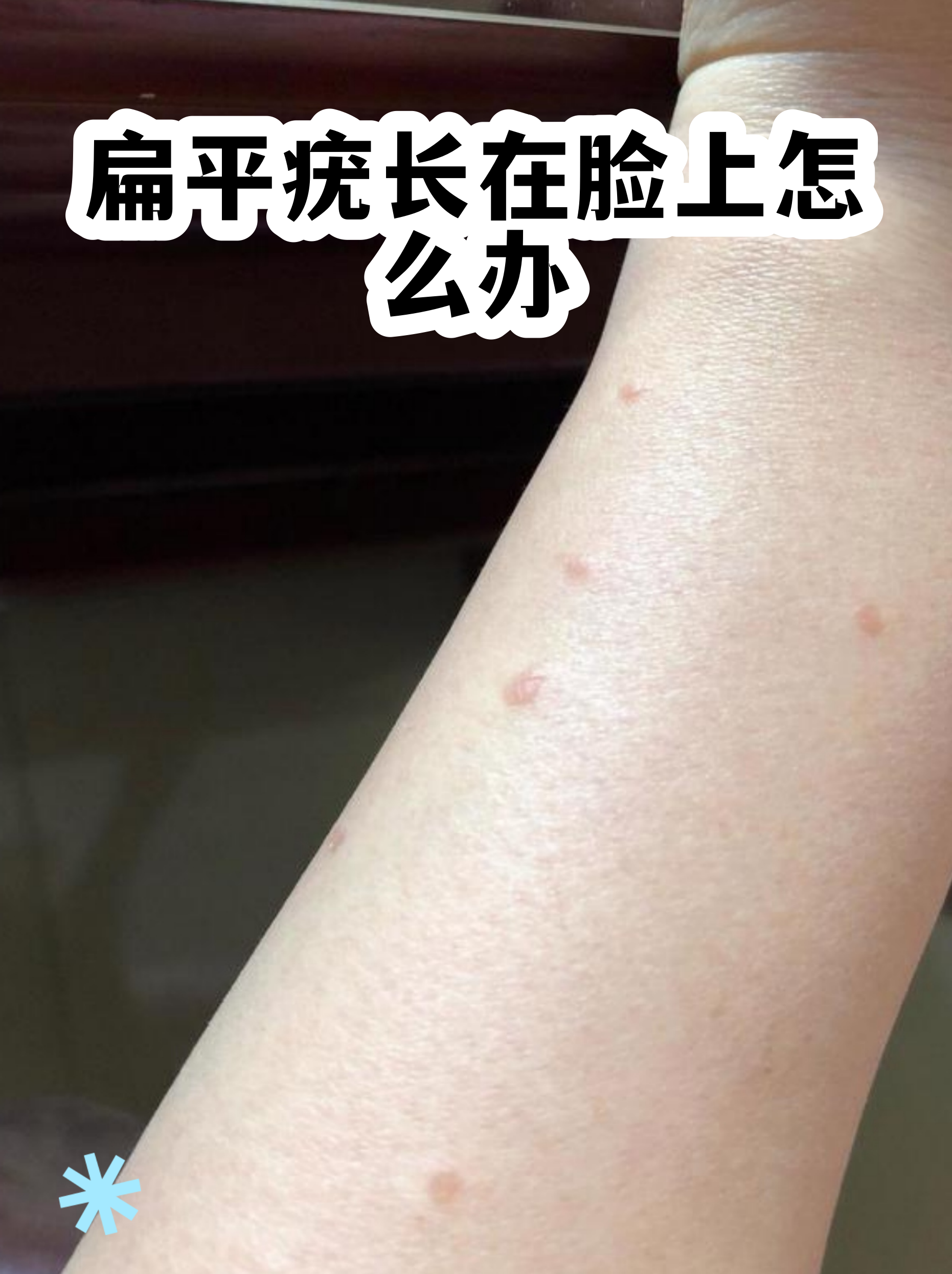  这次病毒严重吗?(病毒又严重了吗)