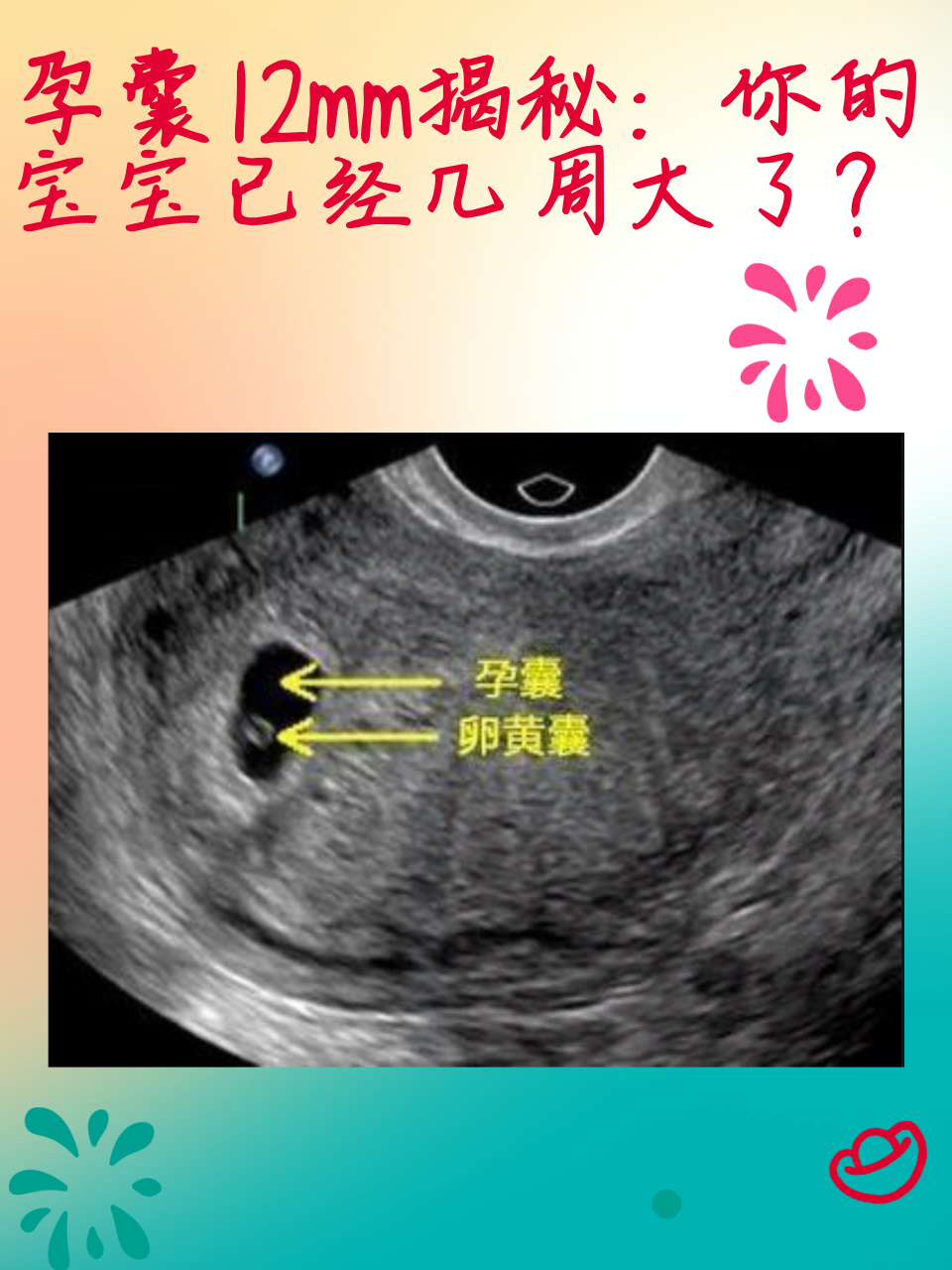 当孕妈妈们在产检中听到孕囊12mm这个数据时,可能会想知道这大概是