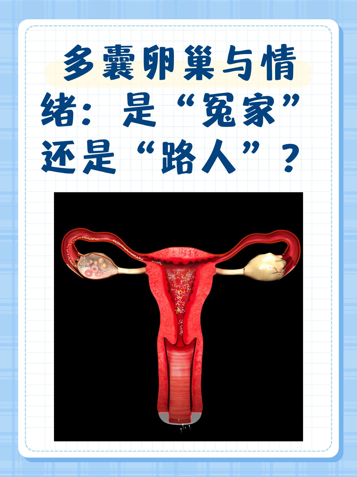 安和卵巢多囊(卵巢多囊和多囊卵巢综合症是一回事吗)  第2张