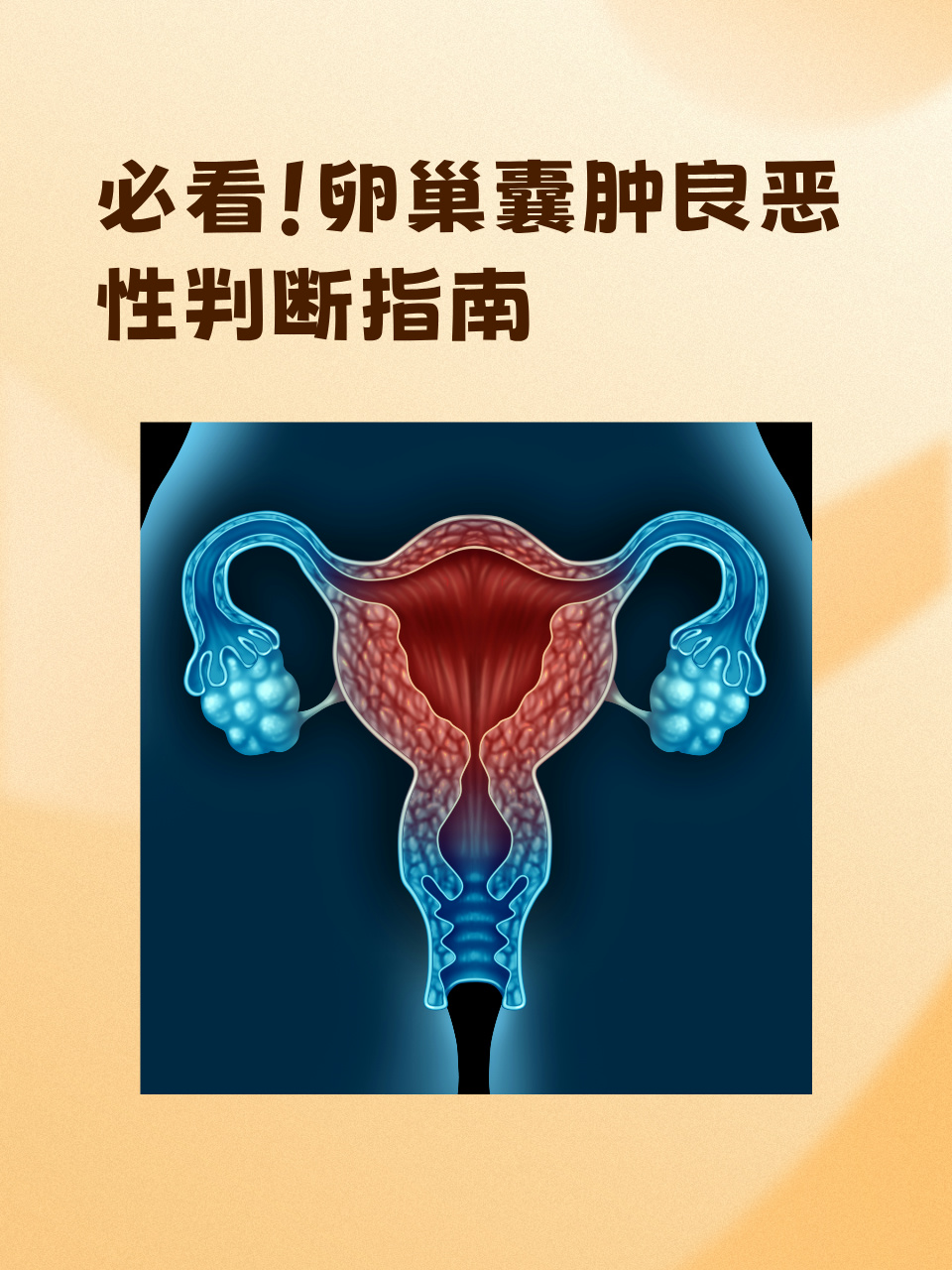 别担心,今天就来给大家讲讲判断卵巢囊肿良恶性的那些事儿